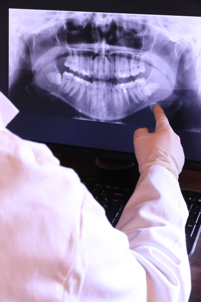 Best Emergency Dentist for Knocked-Out Tooth in Orofino, ID